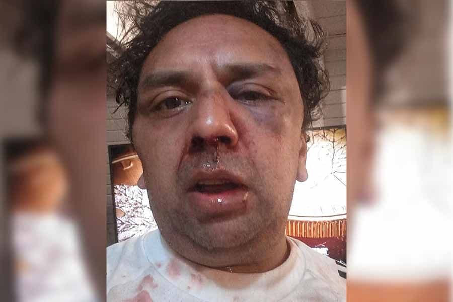 Asaltan a un cocinero en su casa de Valeria del Mar